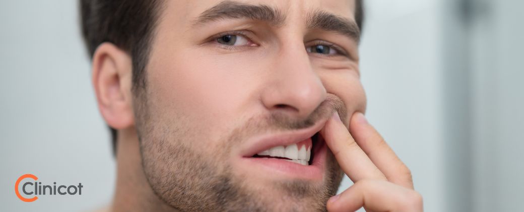 מה הם כיסי חניכיים
